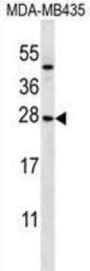 NKG2-A/NKG2-B Type II Integral Membrane Protein (KLRC1) Antibody