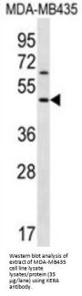 Keratocan (KERA) Antibody