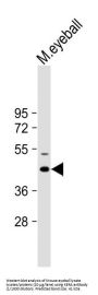 Keratocan (KERA) Antibody