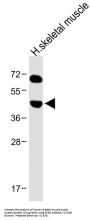 Keratocan (KERA) Antibody