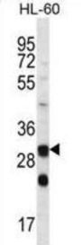 Carbonic Anhydrase 6 (CA6) Antibody