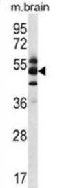 COP9 Signalosome Complex Subunit 1 (GPS1) Antibody