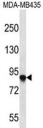 AFAP1 Antibody