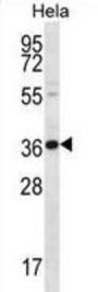 Protein BTG3 (BTG3) Antibody