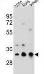 Tropomyosin Alpha-4 Chain (TPM4) Antibody