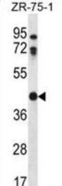 Cathepsin O (CTSO) Antibody