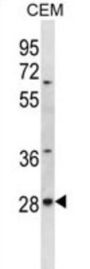 ALKBH4 Antibody