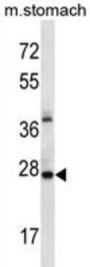 ALKBH4 Antibody