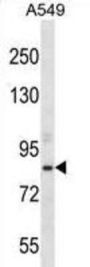 Aspartate Beta Hydroxylase (ASPH) Antibody