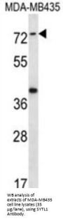 Synaptotagmin-Like Protein 1 (SYTL1) Antibody