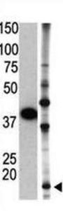 Small Ubiquitin Related Modifier Protein 2 (SUMO2) Antibody