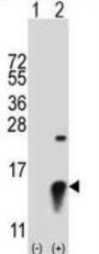 Small Ubiquitin Related Modifier Protein 2 (SUMO2) Antibody