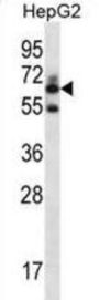 Gamma-Glutamyltransferase 2 (GGT2) Antibody