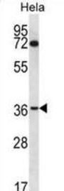 Nucleoporin 35 (NUP35) Antibody