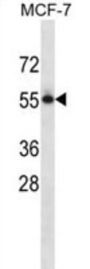 Poliovirus Receptor Related Protein 3 (NECTIN3) Antibody