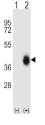 Fc Fragment Of IgA Receptor / CD89 (FCAR) Antibody