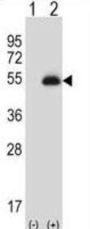 Paired Box Protein Pax-6 (PAX6) Antibody