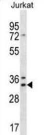 DnaJ (Hsp40) Homolog, Subfamily C, Member 9 (DNAJC9) Antibody