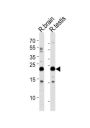 RAB11B, Member RAS Oncogene Family (RAB11B) Antibody