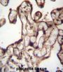MORN3 Antibody