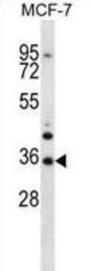 MORN3 Antibody