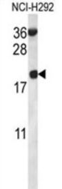Ribosomal Protein S12 (RPS12) Antibody