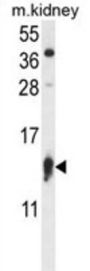 Ribosomal Protein S12 (RPS12) Antibody