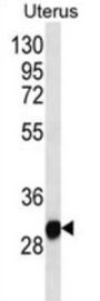 Ring Finger Protein 148 (RNF148) Antibody