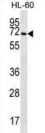 Solute Carrier Family 6 Member 14 (SLC6A14) Antibody