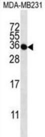 Taste 2 Receptor Member 1 (TAS2R1) Antibody
