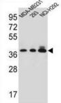 Taste 2 Receptor Member 1 (TAS2R1) Antibody