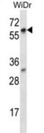 La Ribonucleoprotein Domain Family, Member 7 (LARP7) Antibody