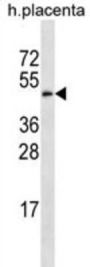Galactose-3-O-Sulfotransferase 4 (GAL3ST4) Antibody