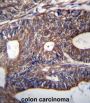Ubiquinol-Cytochrome C Reductase Binding Protein (UQCRB) Antibody