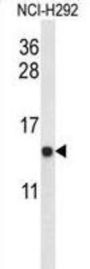 Ubiquinol-Cytochrome C Reductase Binding Protein (UQCRB) Antibody