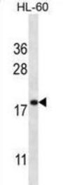 Transmembrane Protein 70, Mitochondrial (TMM70) Antibody