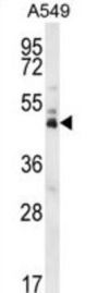 Double Homeobox Protein 4 (DUX4) Antibody