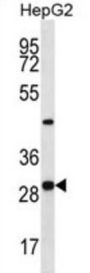 Pyridoxal Phosphate Binding Protein (PROSC) Antibody