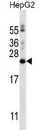 PIGH Antibody