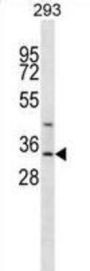 Glycine N-Acyltransferase (GLYAT) Antibody