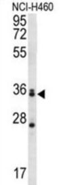 Muscleblind Like Splicing Regulator 3 (MBNL3) Antibody