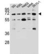 Potassium Voltage-Gated Channel Subfamily V Member 2 (KCNV2) Antibody