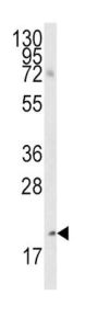 Bmf BH3 Domain Antibody