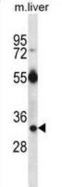 RAS, Dexamethasone-Induced 1 (RASD1) Antibody