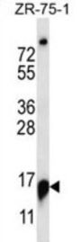Ribonuclease P And MRP Subunit P25 (RPP25) Antibody