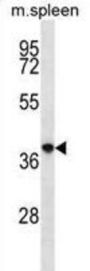 PQ-Loop Repeat-Containing Protein 2 (PQLC2) Antibody