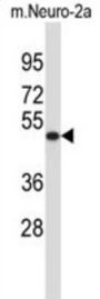 VAT1L Antibody