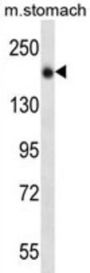 UNC13B Antibody