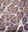 Prefoldin Subunit 5 (PFDN5) Antibody