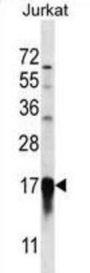 Prefoldin Subunit 5 (PFDN5) Antibody